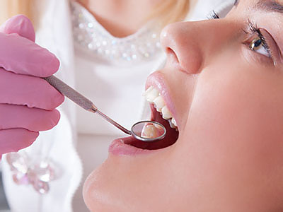 A woman receiving dental care with a hygienist performing the procedure.