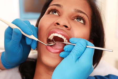 A woman receiving dental care from a professional in a dental office setting, with her mouth open and a dental instrument in use.