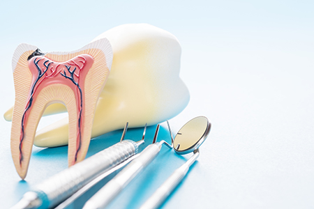 The image shows two sides of a dental model with tooth fillings, accompanied by surgical instruments and medical equipment, placed on a blue background.